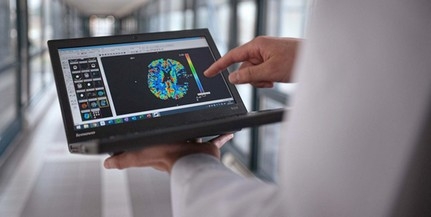 Mesterséges intelligencia segíti a stroke kezelését - Egyedülálló megoldást dolgoztak ki pécsi orvosok Mesterséges intelligencia segíti a stroke kezelését - Egyedülálló megoldást dolgoztak ki pécsi orvosok