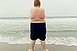 Az elhízott gyerekeknél többszörösére nő az epekő kockázata Az elhízott gyerekeknél többszörösére nő az epekő kockázata